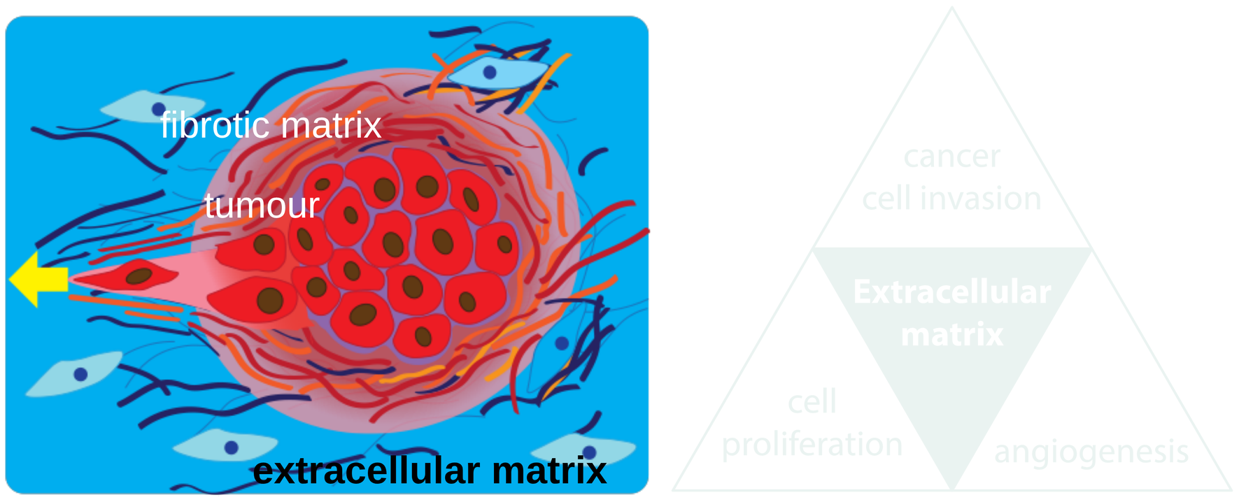 A tumour wrapped in fibrotic matrix within the extracellular matrix; and the extracellular matrix at the centre of cancer cell invasion, cell proliferation and angiogenesis