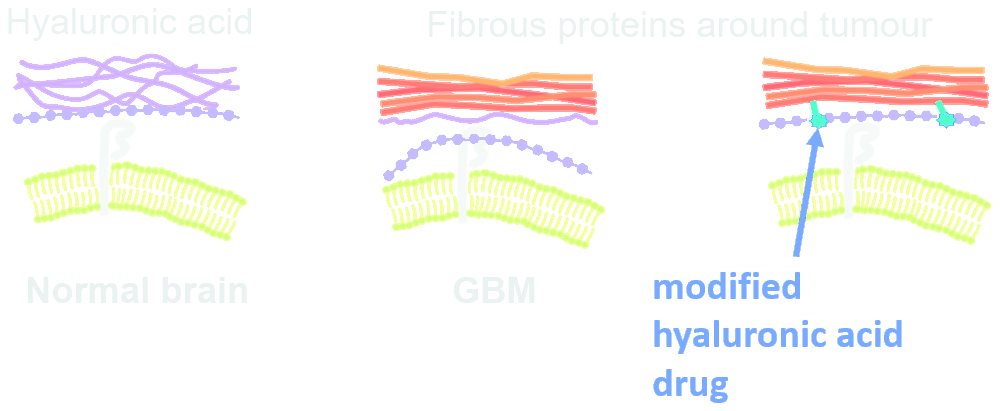 Hyaluronic acid in normal brain; fibrous proteins around the tumour in GBM; and the modified hyaluronic acid drug binding them
